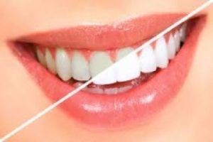 מרפאת שיניים מומלצת בהובלת דר' קלריסה מור-גן